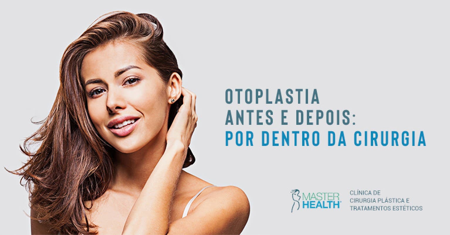 Otoplastia Antes E Depois Por Dentro Da Cirurgia Blog Master Health