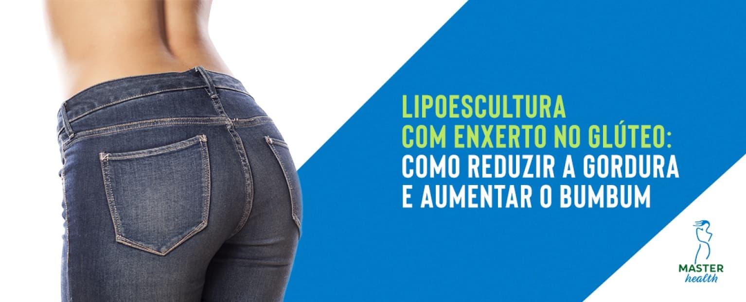 Lipoescultura com enxerto no glúteo: como funciona? - Master Health