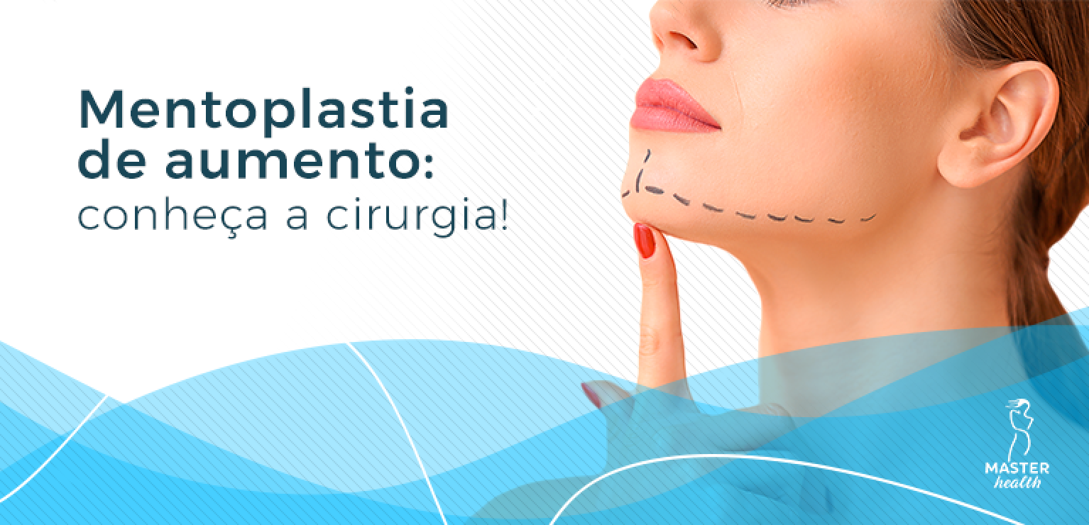 Mentoplastia de aumento e projeção do queixo Blog Master Health