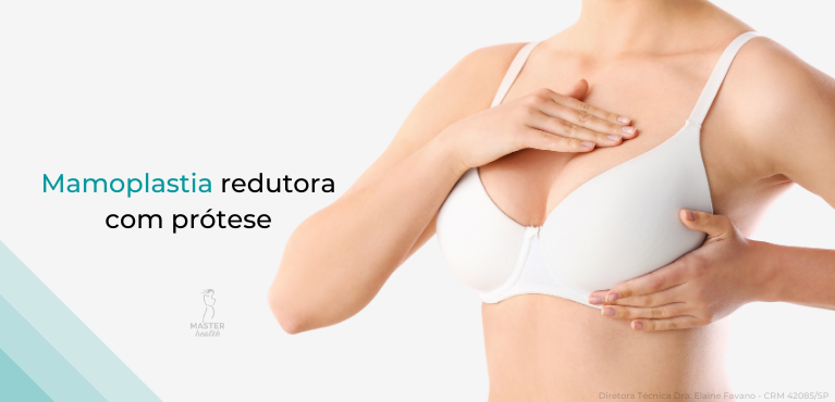 mamoplastia-redutora-protese-01-master-health