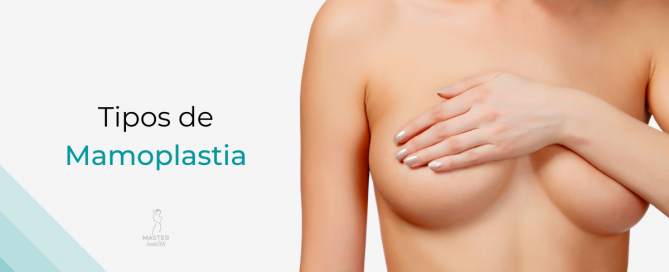 tipos-mamoplastia-03-master-health.