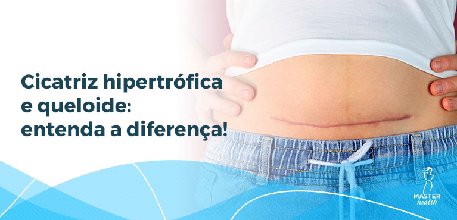 Cicatriz hipertrófica ou queloide? - Blog Master Health