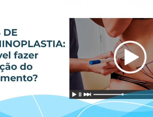 Vídeos de abdominoplastia: como é feita essa cirurgia plástica?