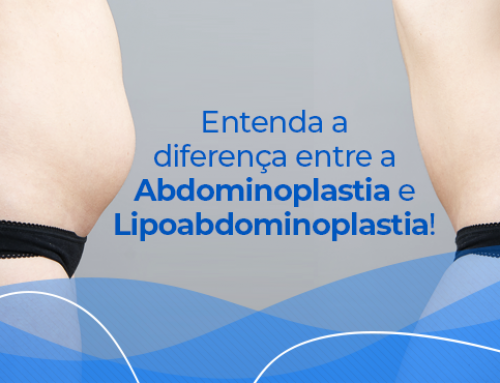 Diferença entre a abdominoplastia e lipoabdominoplastia: entenda quando cada procedimento é indicado!