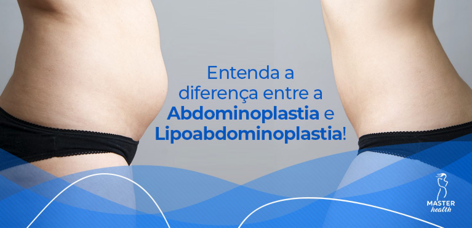 Diferença entre a abdominoplastia e lipoabdominoplastia - Blog Master