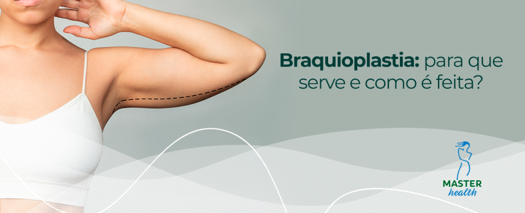 Braquioplastia: conheça a plástica para os braços - Blog Master Health