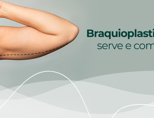 Braquioplastia: para que serve e como é feita a cirurgia plástica dos braços?
