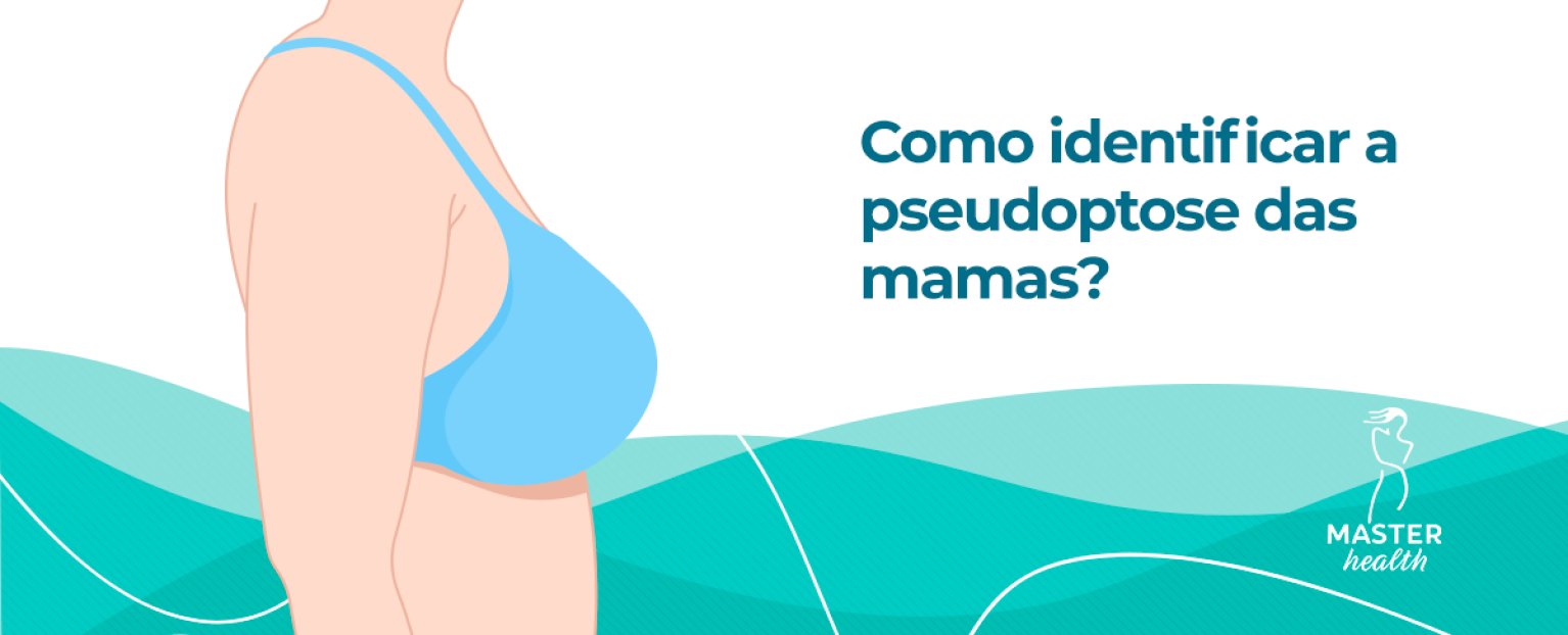 Pseudoptose Nas Mamas Como Identificar E Corrigir Blog Master Health