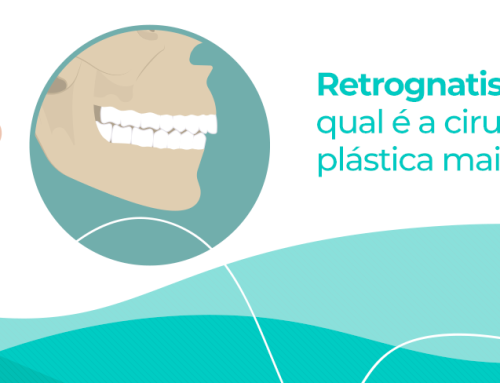 Retrognatismo: qual é a cirurgia plástica mais indicada?