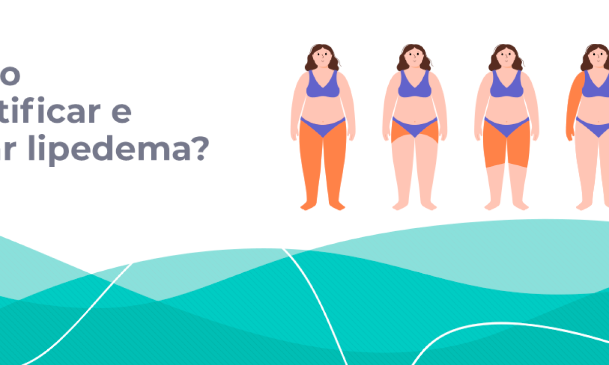 O lipedema é uma inflamação de baixo grau do tecido gorduroso. Lipedema não  é gordura.