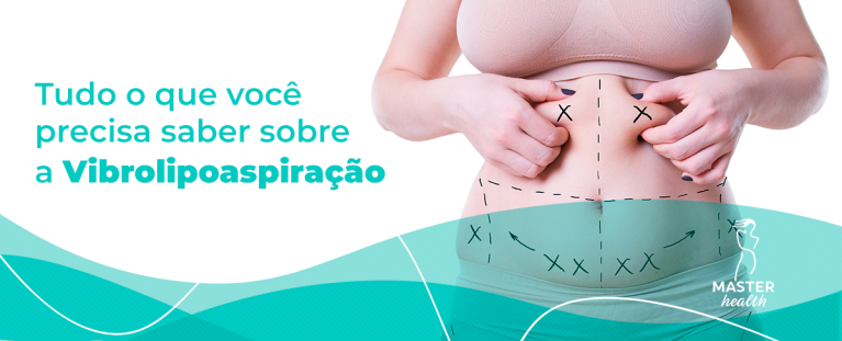 Imagem mostrando a barriga de uma mulher com várias marcações pontilhadas