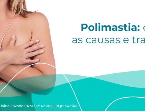 Polimastia: será que você tem mais de duas mamas? Conheça as causas e tratamento.